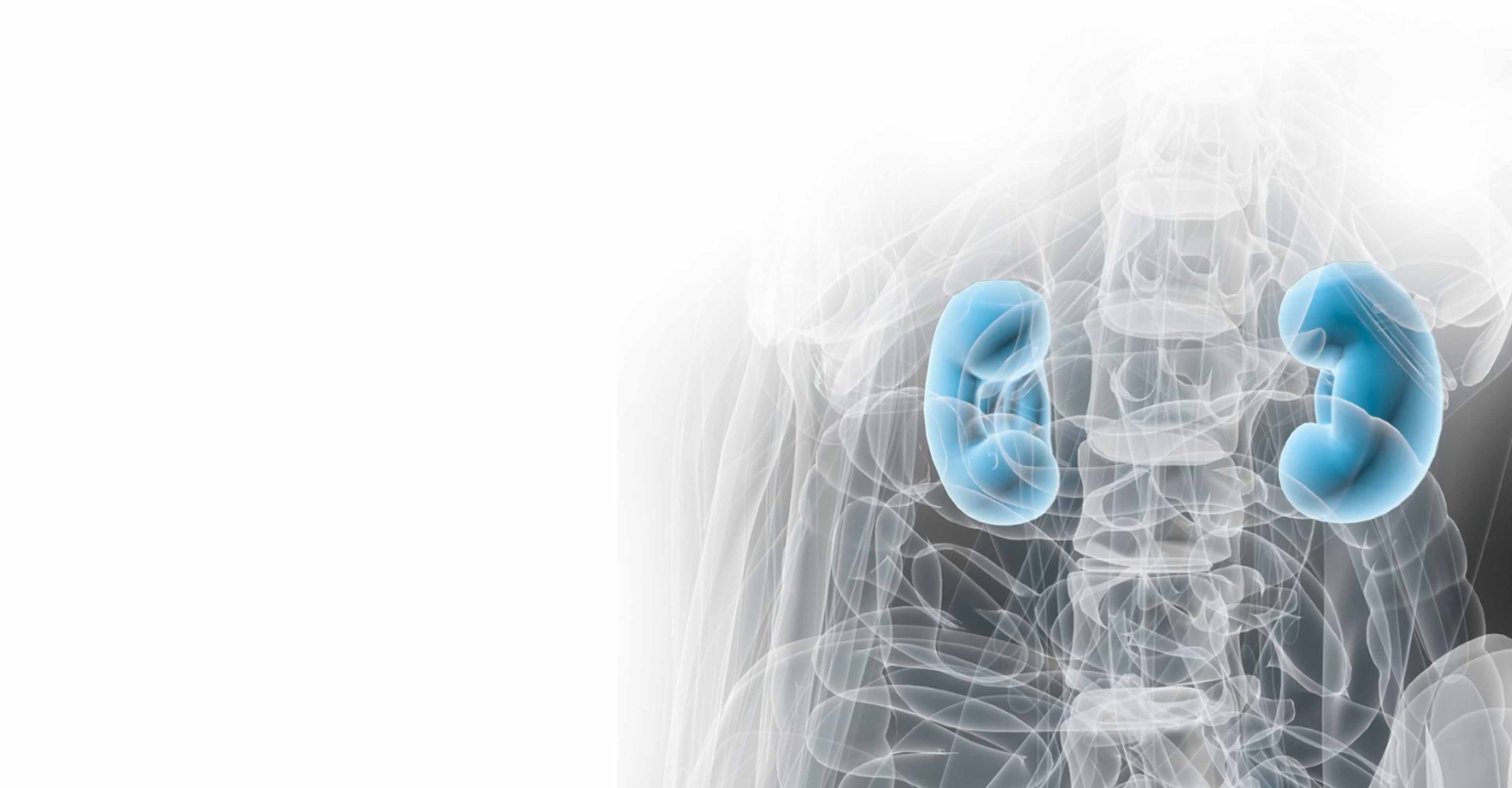 Radiotherapy for Kidney cancer | Elekta