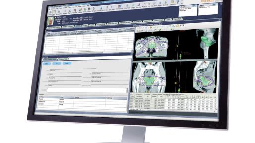 MOSAIQ radiation patient profile on a monitor