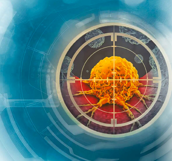 Radiotherapy Impact Report