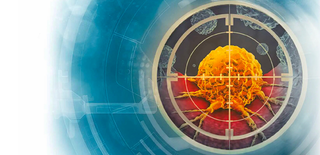 Radiotherapy Impact Report