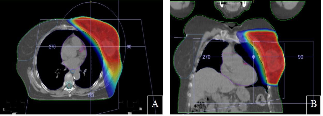 Axial and Coronal Ct Slices