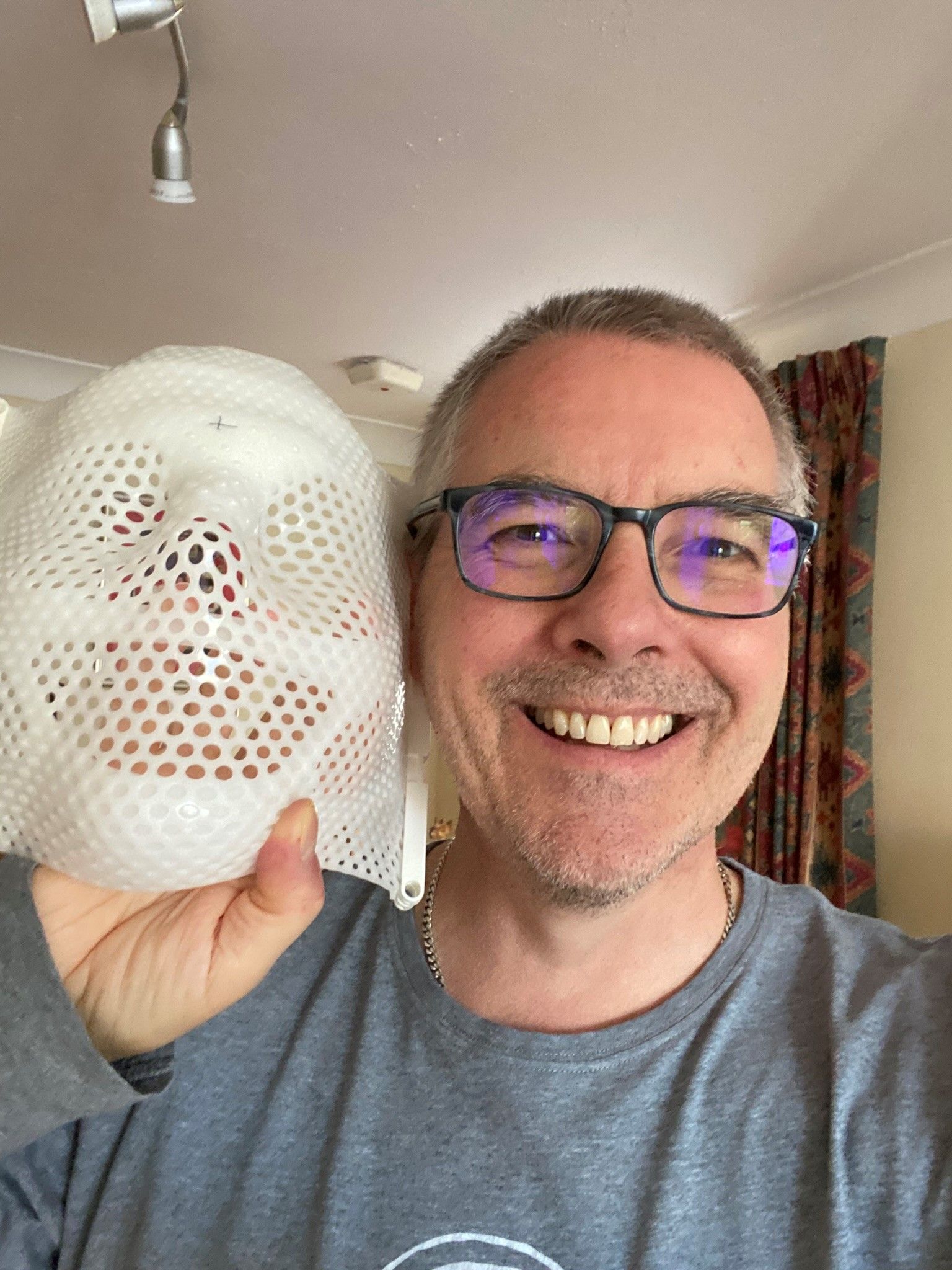 Andy Tudor and his stereotactic radiosurgery mask