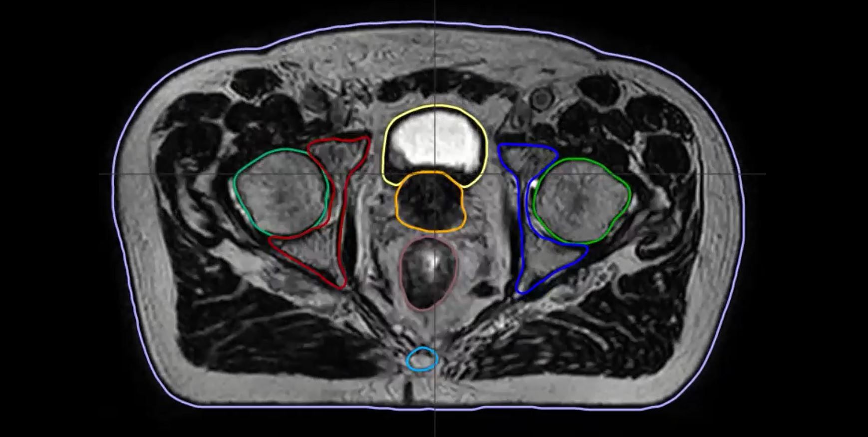 Figure 1 showing several automatically contoured images