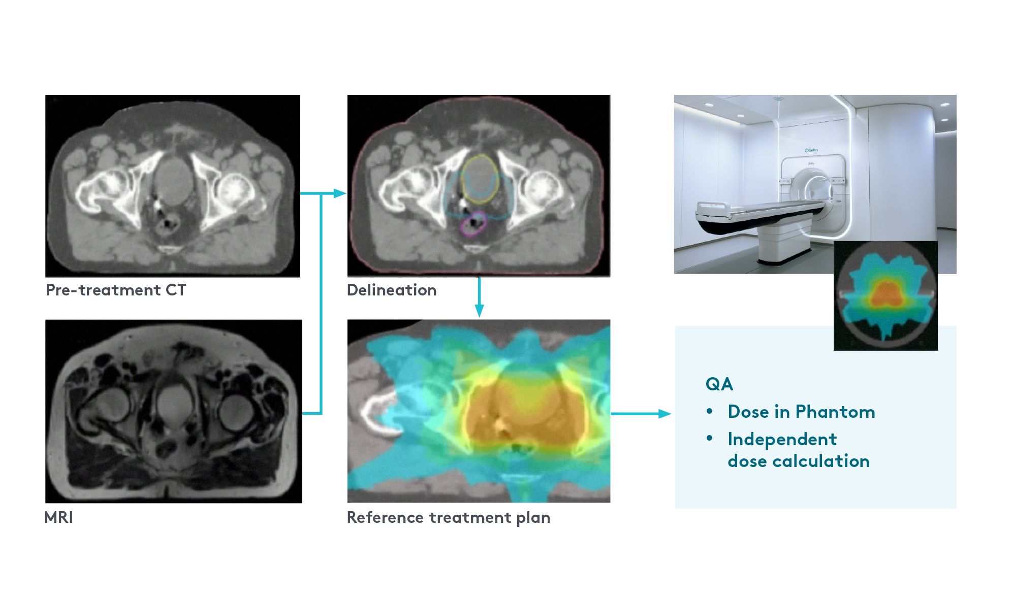 Figure 1. The offline pretreatment planning workflow for Elekta Unity