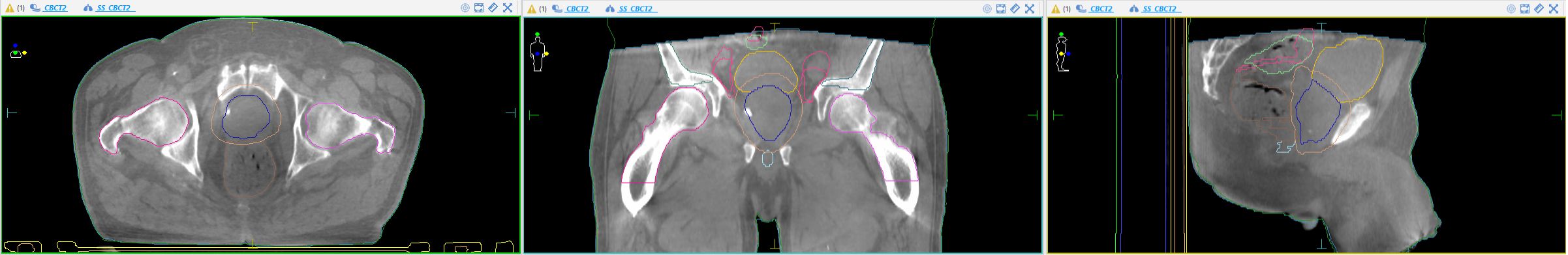 Iris High Definition AI Enhanced Imaging