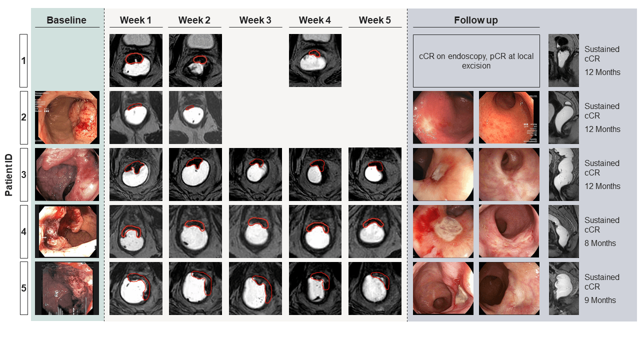 Endoscopic findings