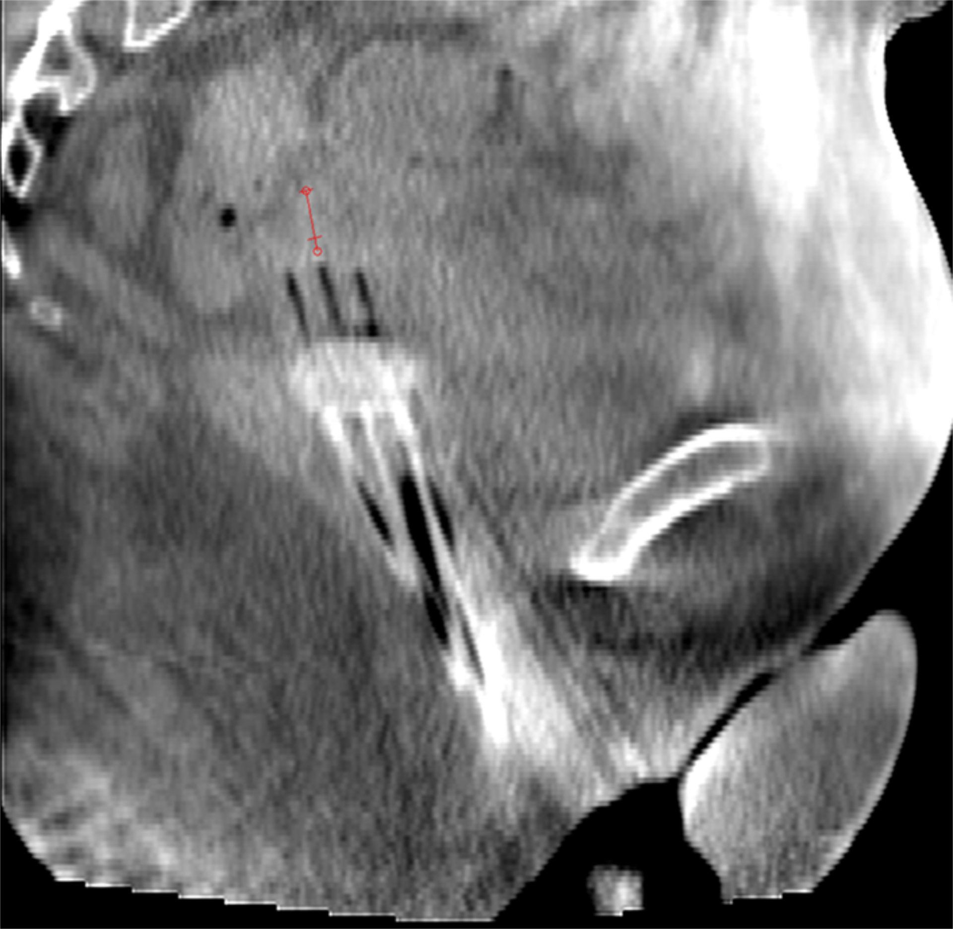 Figure 1 Italy Article