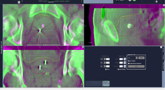 Figure 2. Images are aligned using the gold fiducials.