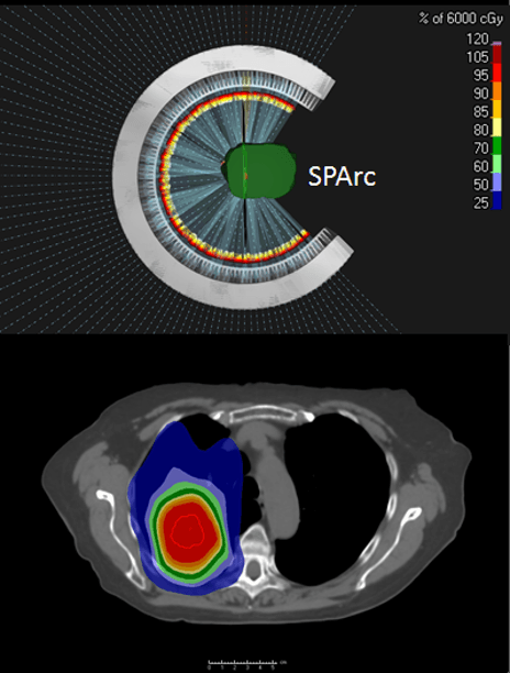 Proton Therapy