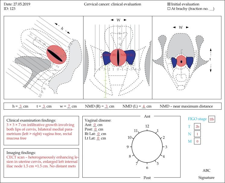 Figure 1. An example of clinical drawing for three-dimensional documentation of disease.