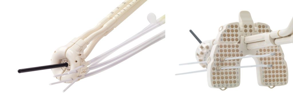 The Venezia applicator with an example of oblique needle placement (left) and with perineal template (right)