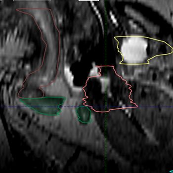 Case 1 Upper Right