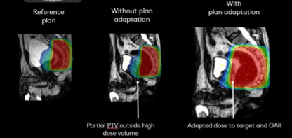 Adapted Plan