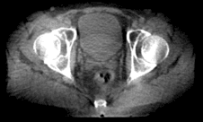 CBCT image