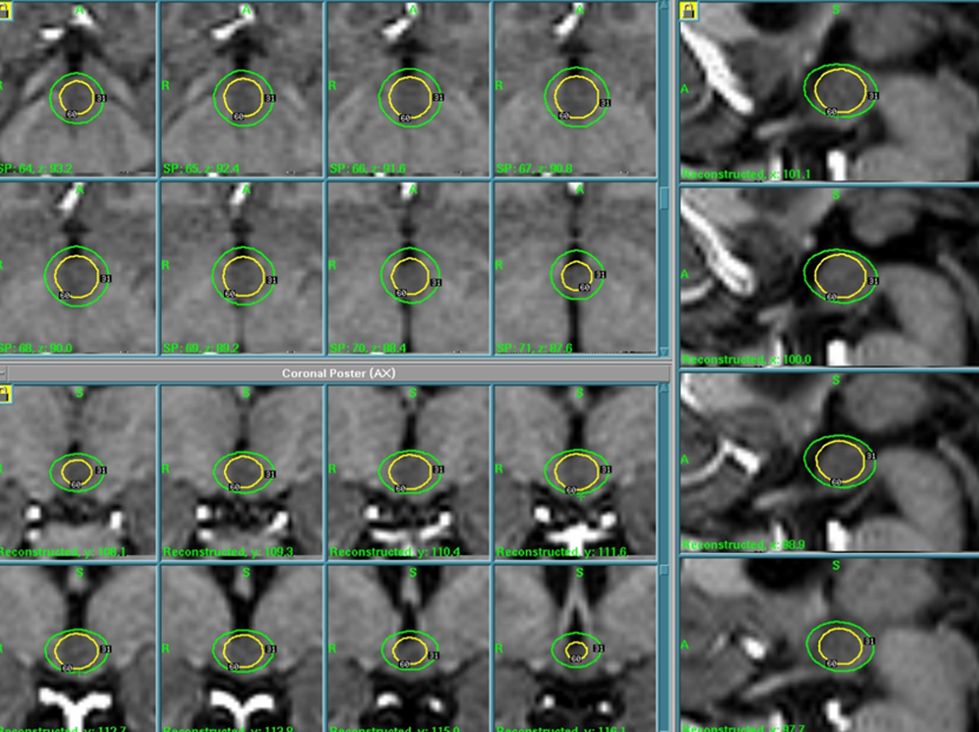 Treatment Plan for Hh Case Example 1