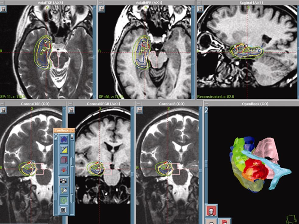 Treatment Plan for Mtle Case Example 1