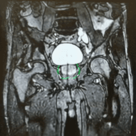 Quality of Mr Imaging