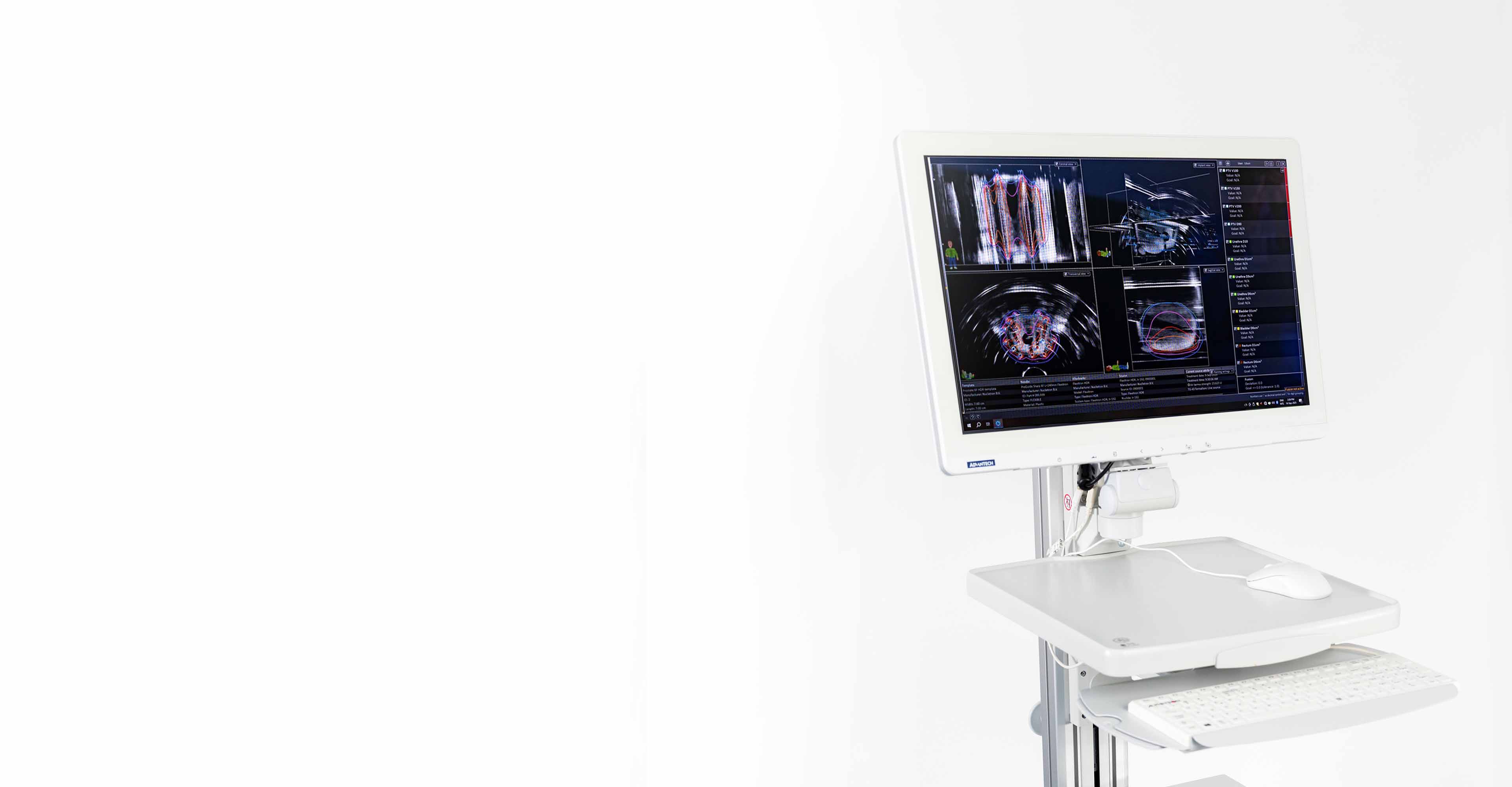 Prostate Guideway | Real-Time Adaptive Brachytherapy