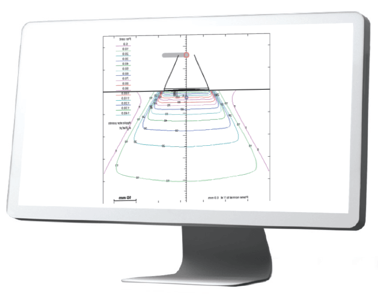 Dose distribution plan with Valencia skin applicator