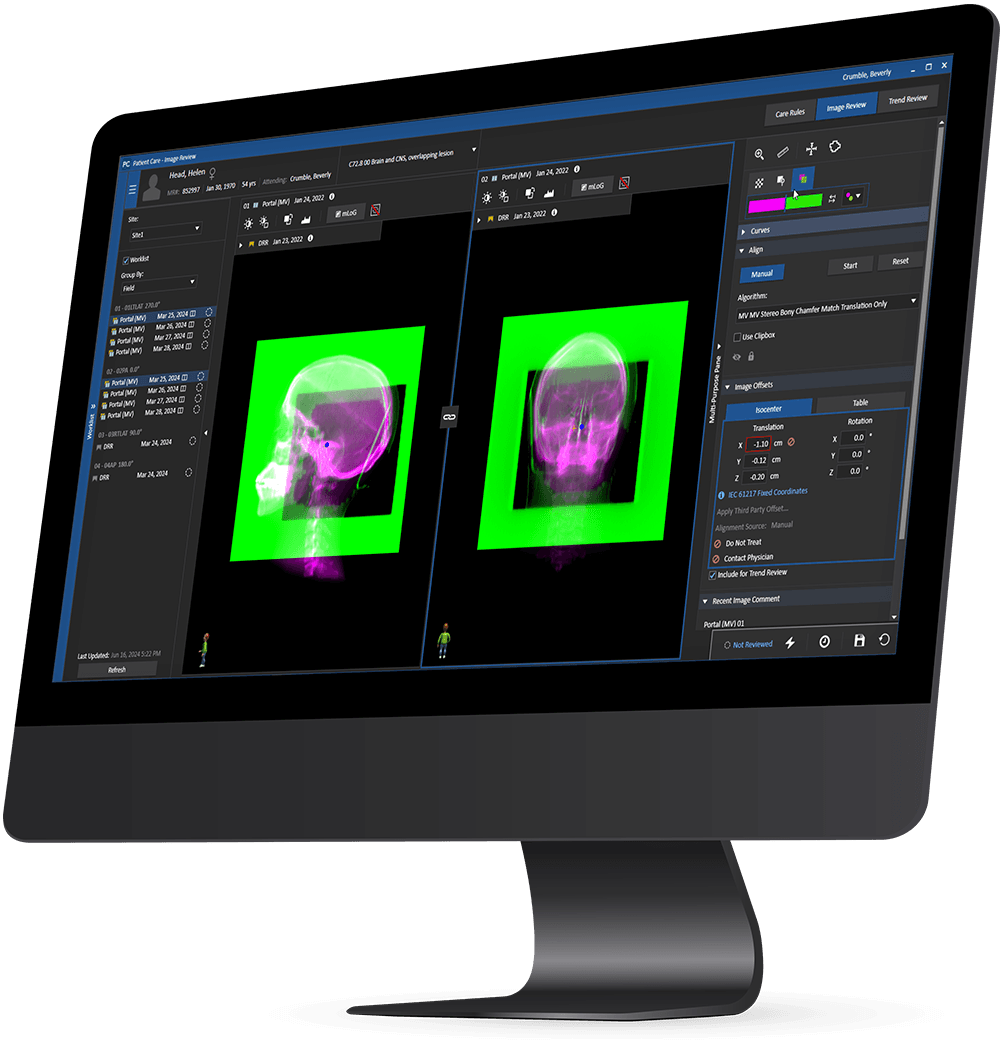 MOSAIQ on desktop computer screen