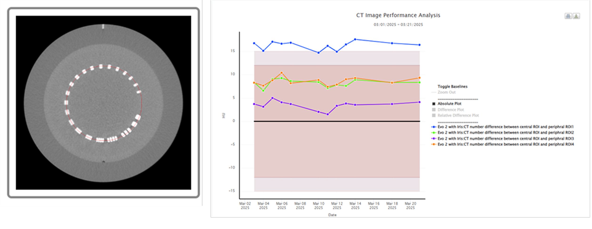 Ct Image Performance Analysis Graph