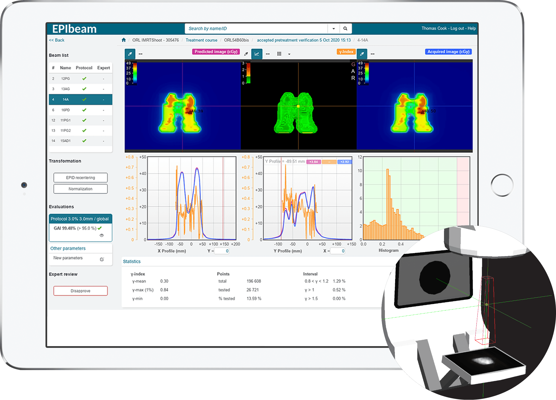 I Pad Qa Ep Ibeam Rebranded Elekta Pretreatmentwith Epid 2024