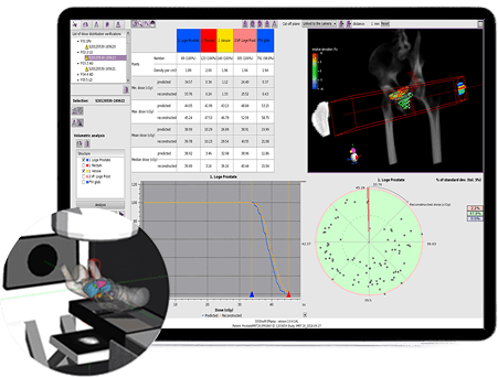Epid Based in Vivo Dosimetry