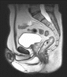 Pelvis cine