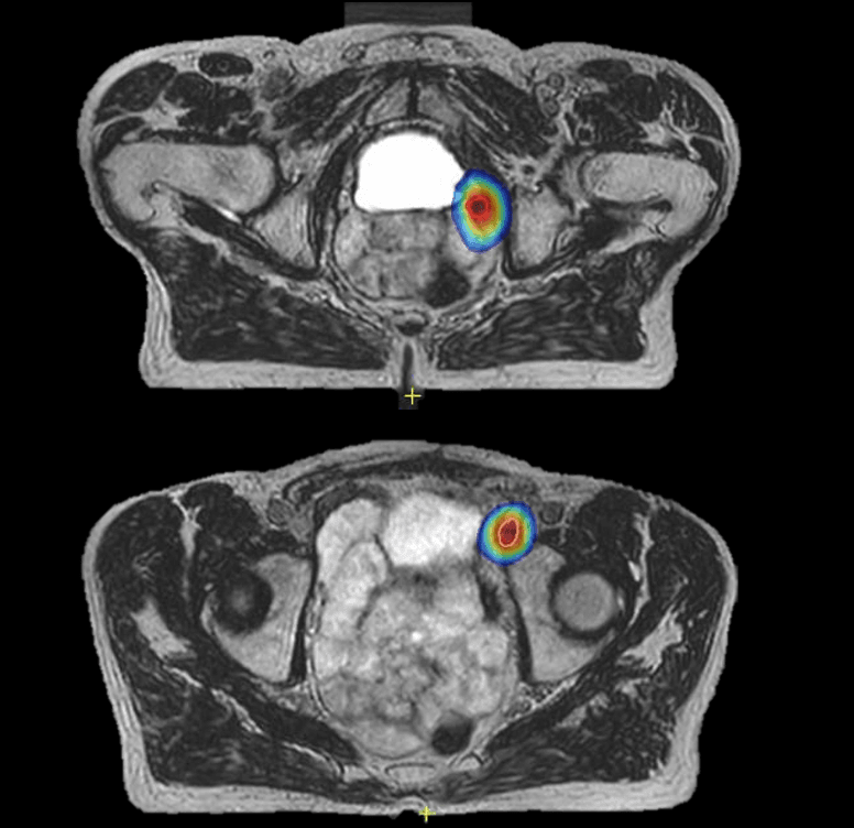 T2 images acquired on Elekta Unity