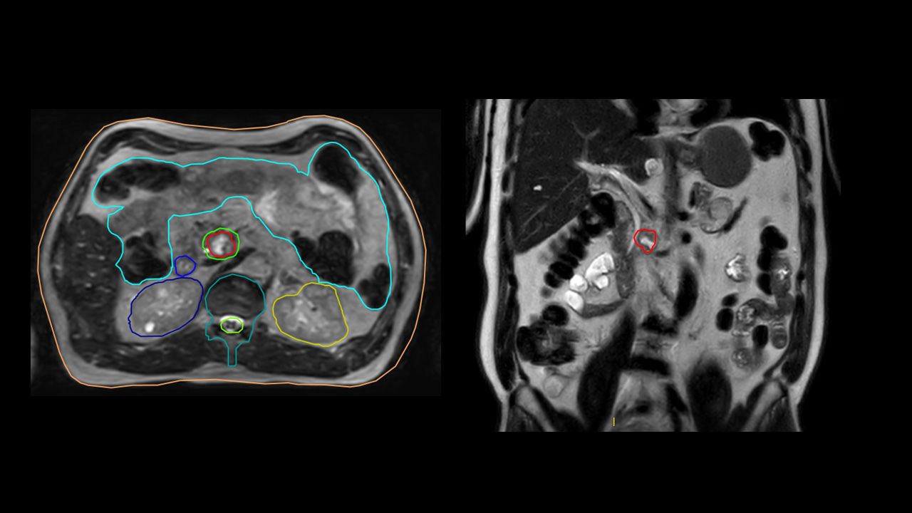 Pancreas Image 3