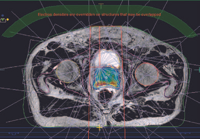 Fiducial-free case study