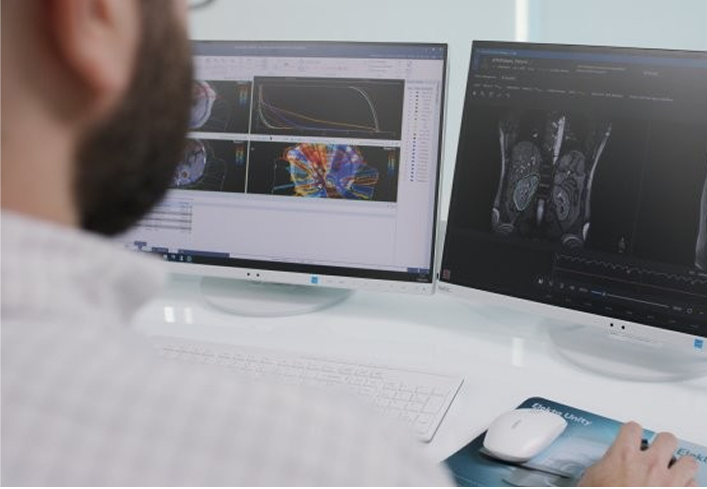 MR-guided adaptive radiotherapy workspace
