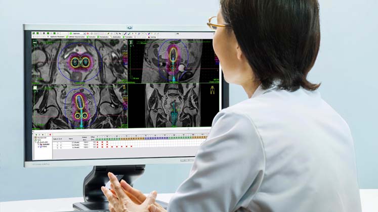 Woman sitting at desk in front of computer screen using Oncentra Brachy 3D planning software